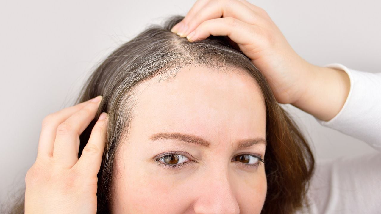 Mascarilla casera con para erradicar las canas y prevenir la caída cabello; así se prepara