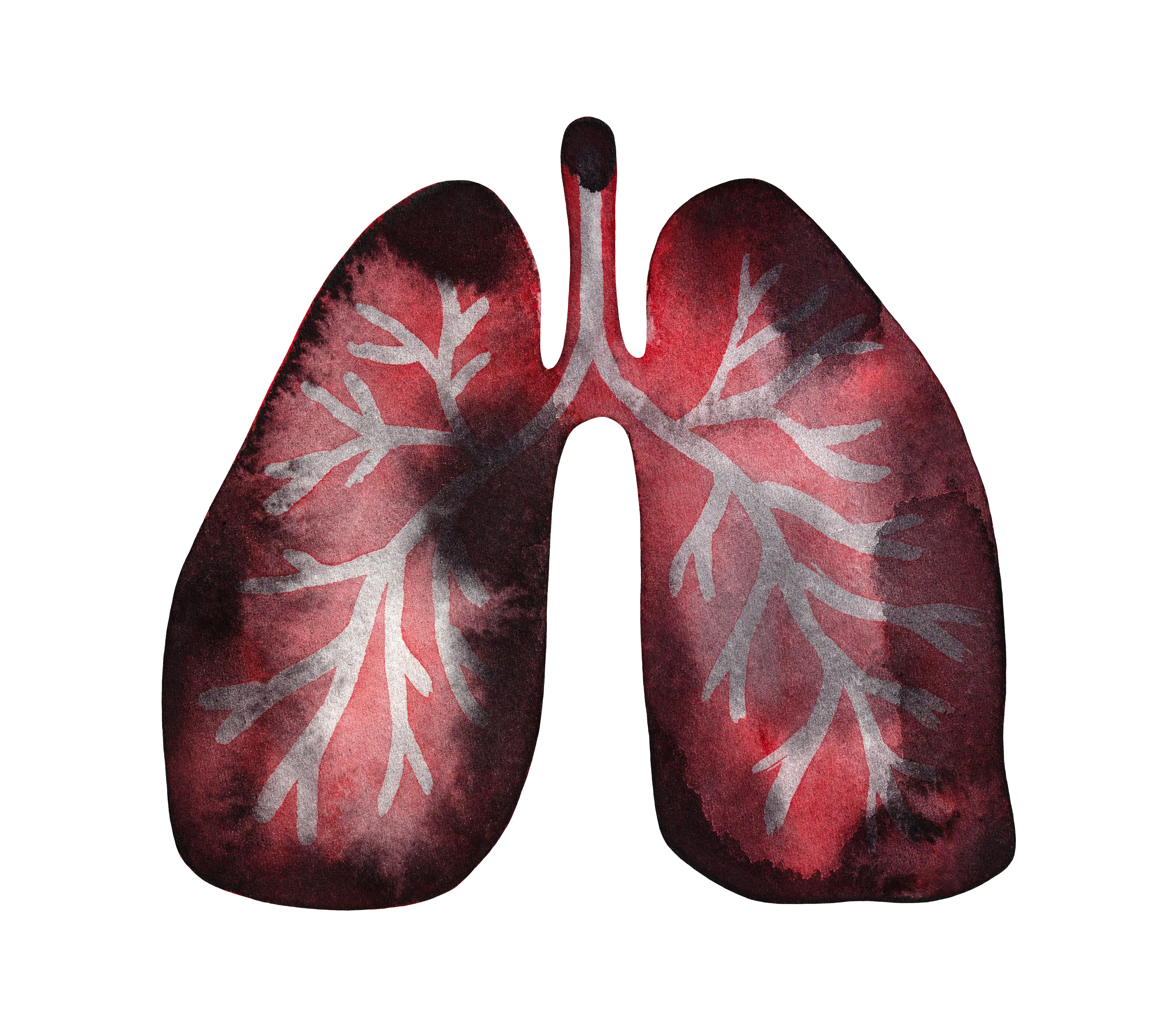 ¿Cómo prevenir el pulmón negro