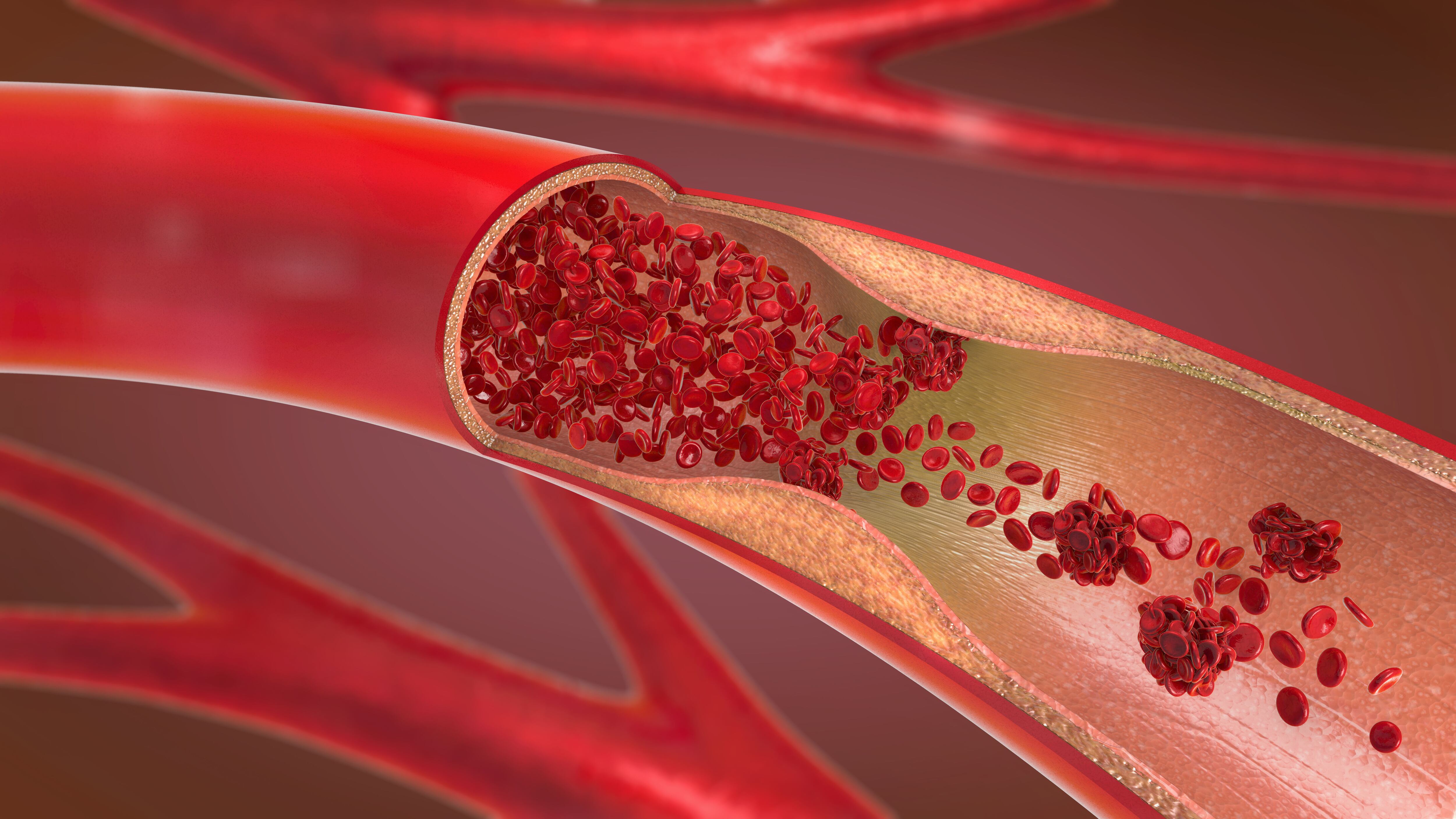 La fibra protege tus arterias para evitar enfermedades del corazón