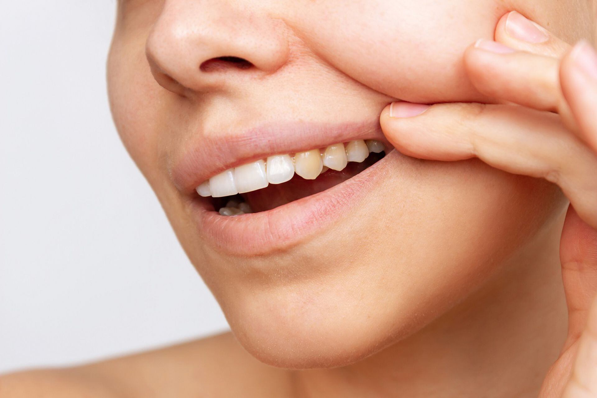 Sarro en los dientes: tres remedios caseros para eliminarlo