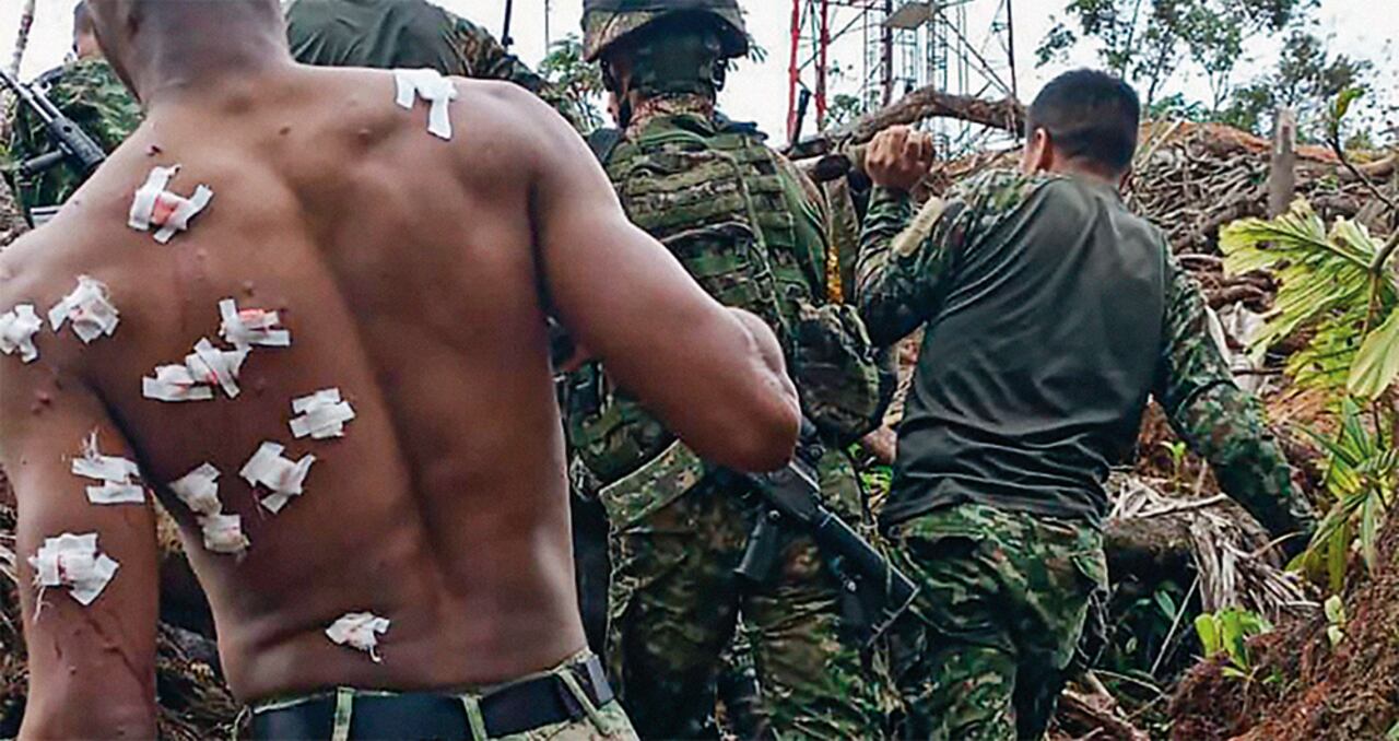   Las gasas blancas que cubren la espalda del soldado tapan las heridas causadas con la metralla del explosivo que llevaba un dron.