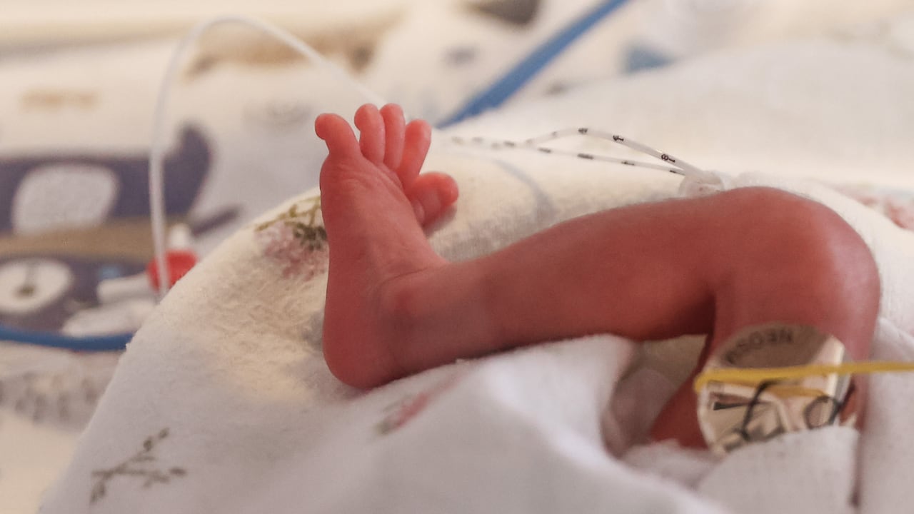 La pierna de un bebé prematuro. Imagen de referencia