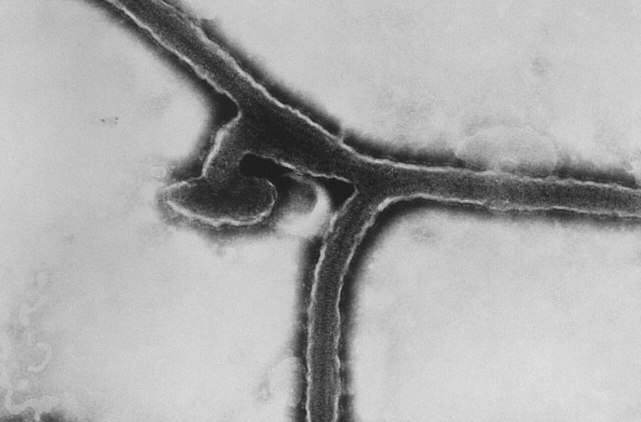 Vista microscópica del virus de Marburgo.