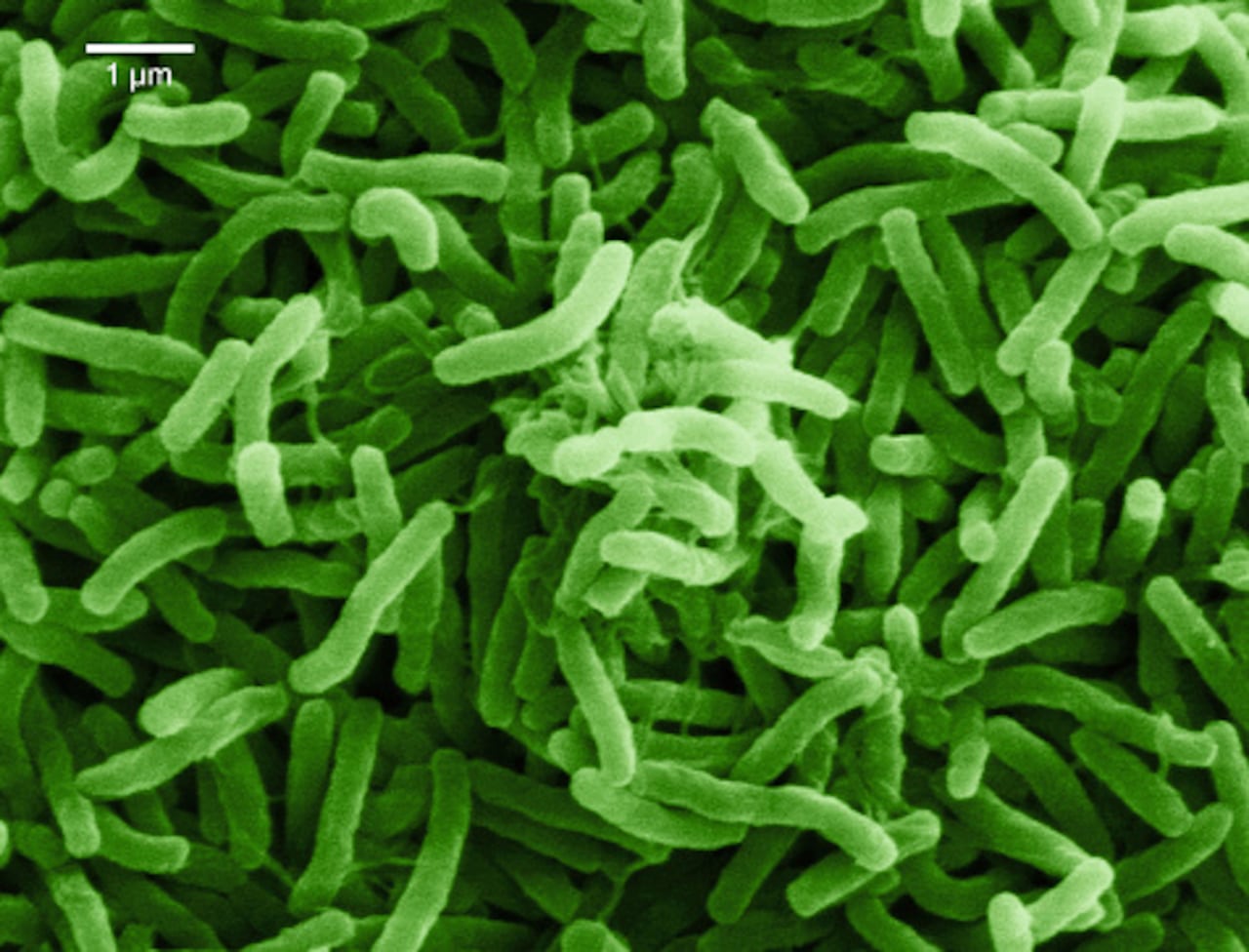 Vista microscópica de la bacteria que causa el cólera.