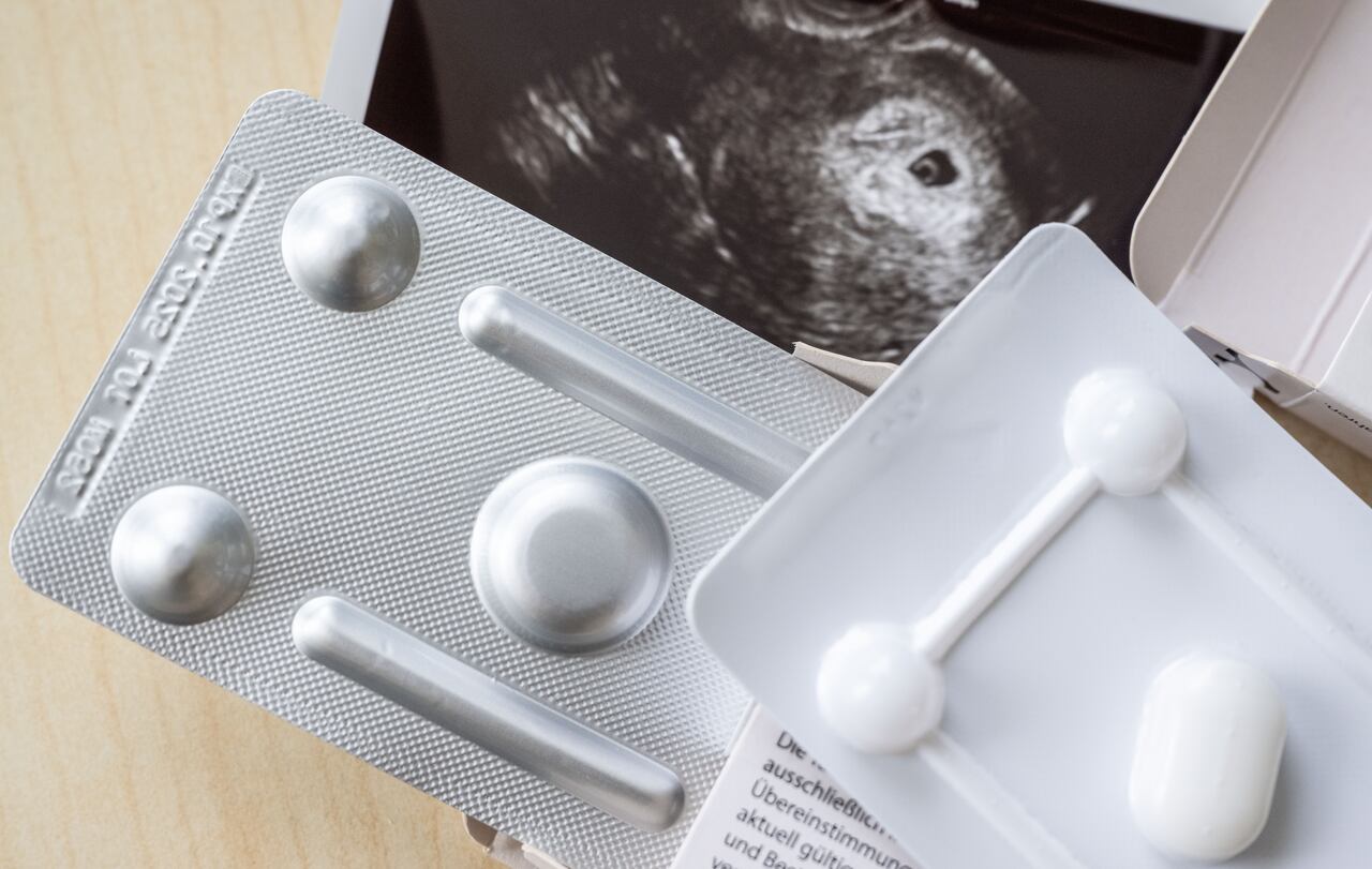 En la consulta del ginecólogo se pueden ver medicamentos para interrumpir el embarazo delante de una imagen ecográfica.