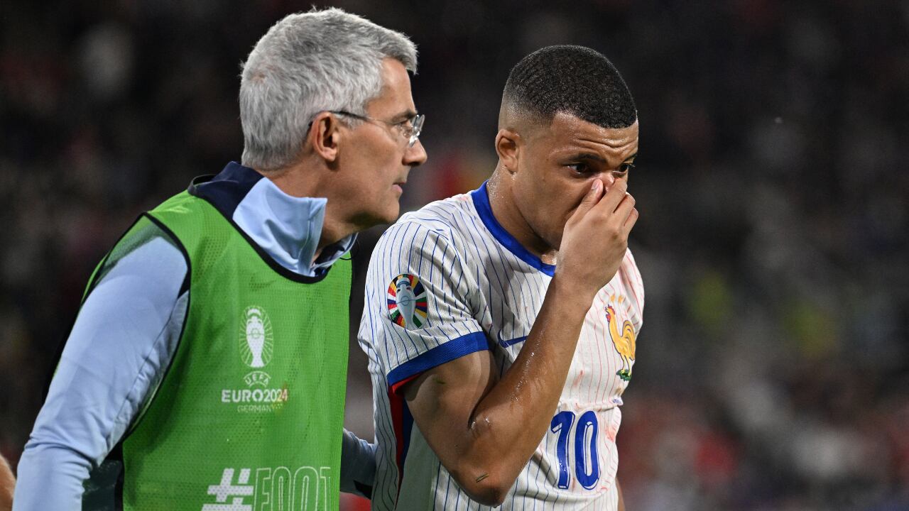 Kylian Mbappé tras salir lesionado con Francia en la Eurocopa 2024