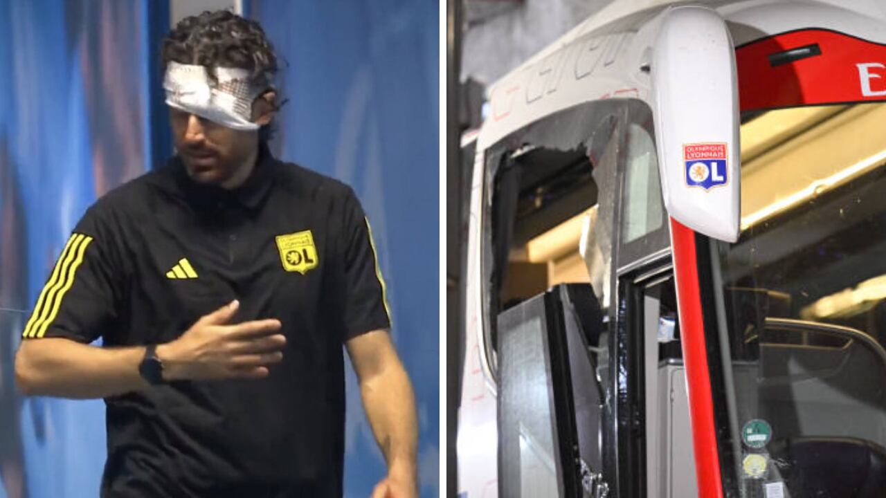 Fabio Grosso sufrió afectaciones en su rostro tras el ataque del bus al Lyon