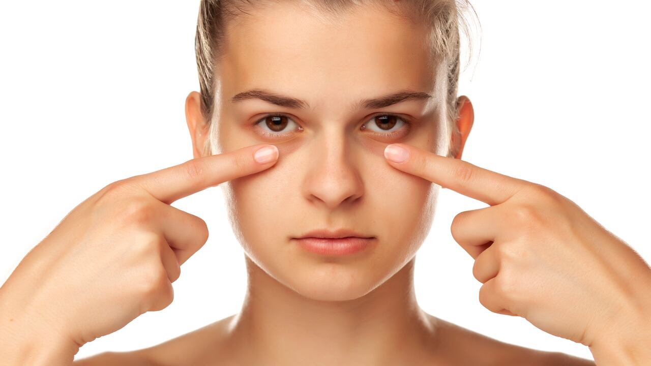 Descubra cómo disminuir las bolsas de los ojos utilizando remedios naturales y su correcta preparación
