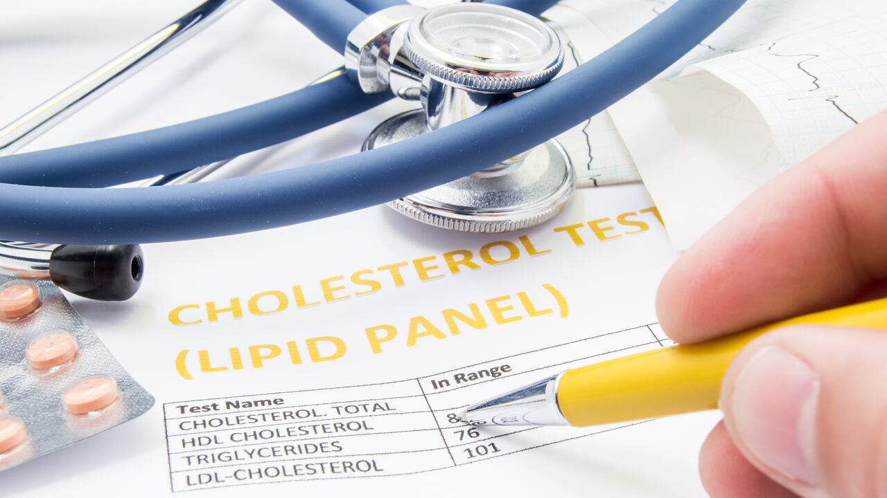 Niveles de triglicéridos, colesterol