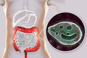 Los parásitos intestinales pueden generan diversas afecciones de salud.