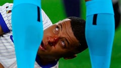 El francés Kylian Mbappé reacciona tras sufrir una lesión durante la Eurocopa 2024