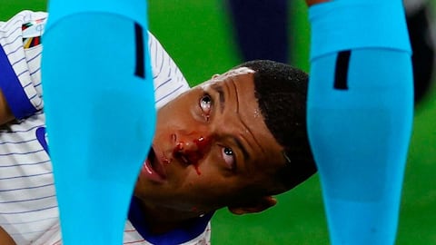 El francés Kylian Mbappé reacciona tras sufrir una lesión durante la Eurocopa 2024