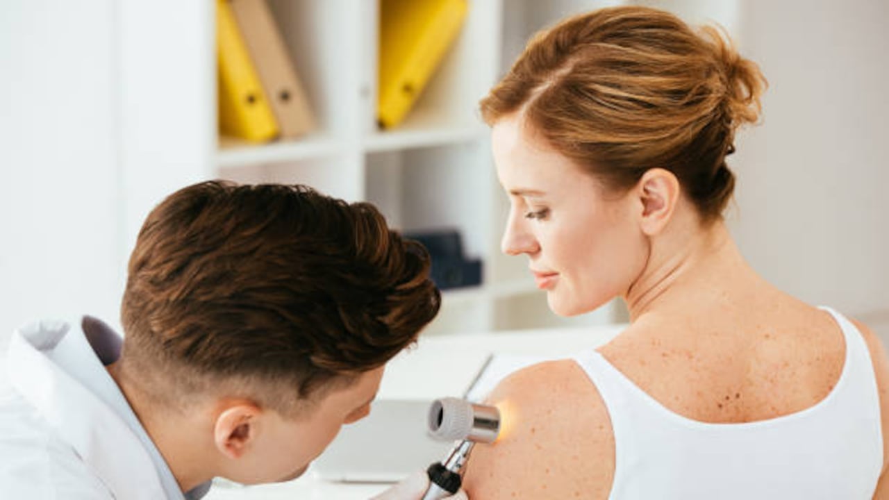 El 90% de los casos de cáncer de piel pueden ser tratados si se detectan a tiempo.
