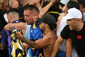 Un aficionado de argentino tiene una herida en su rostro, en medio de la trifulca que se presentó en el juego entre Brasil y Argentina, en el Maracaná, en las Eliminatorias Sudamericanas 2026.  /Foto  CARL DE SOUZA / AFP)