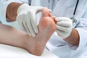 Esta infección en la piel la padecen las personas que usan medias húmedas o zapatos muy apretados.