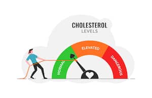Los niveles elevados de colesterol pueden afectar la salud de los ojos.