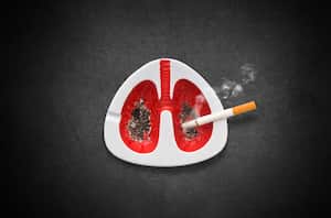 Esto se tardan los pulmones de una persona que fuma en recuperarse.